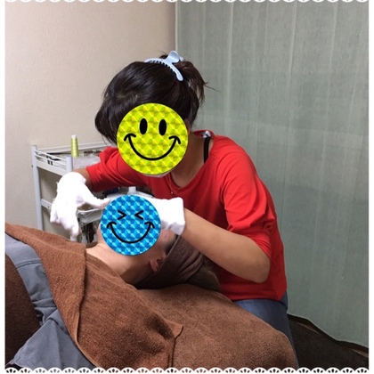 シルク糸脱毛